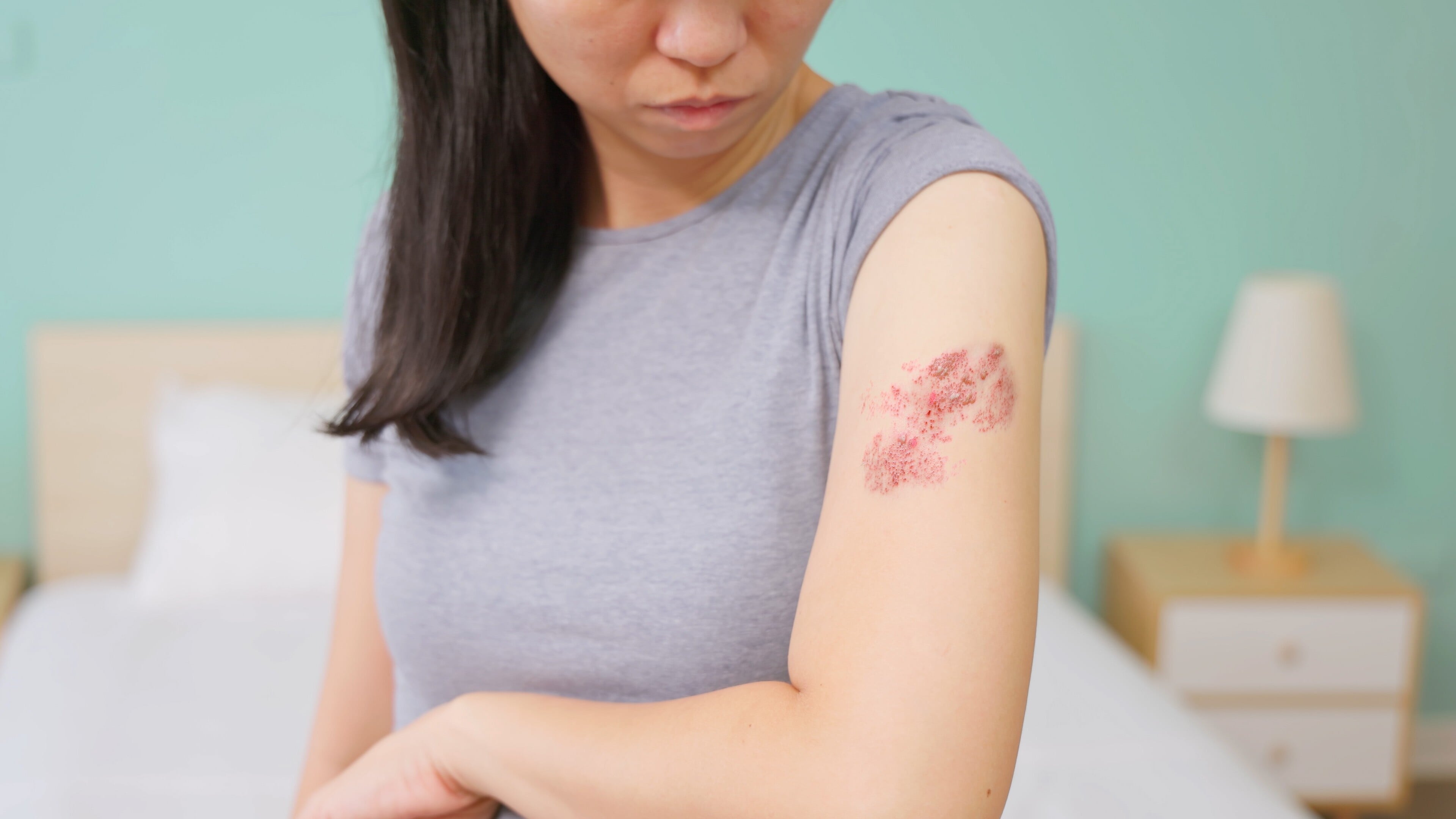 癌症病人為何要關心「生蛇」？