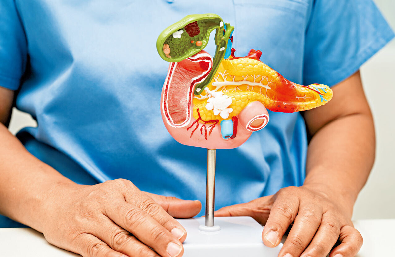 眼黃、尿茶色＝膽管癌最後警號