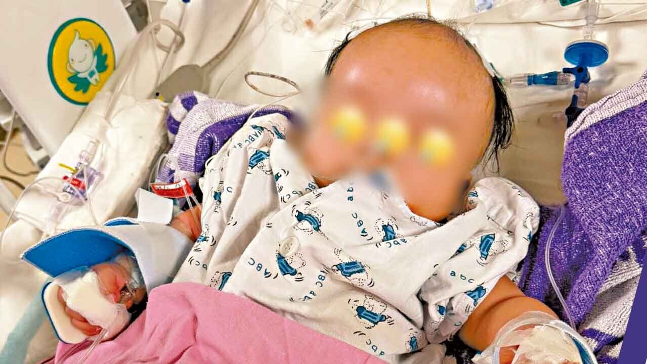 4個月大男嬰疑遭搖晃致腦出血 兩外傭涉案被捕 16個月胞兄同受虐