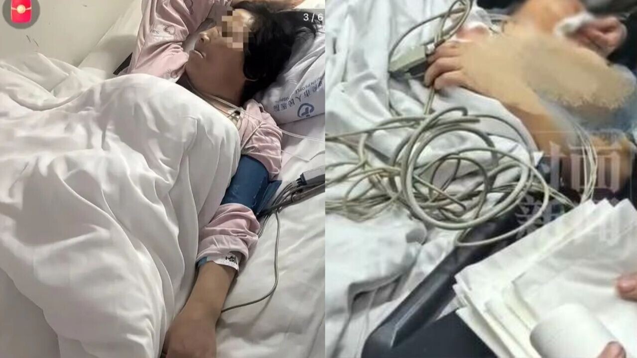 剝3隻牙變一口氣拔12隻 53歲婦人心肌梗塞命危
