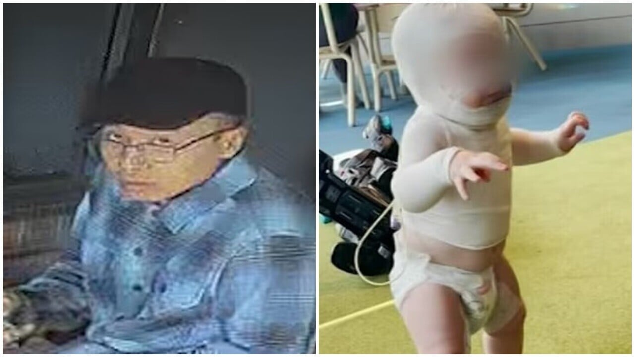 澳洲嬰遭潑熱咖啡全身60%燙傷，疑犯身處中國，中方小組將聯合調查。(X)