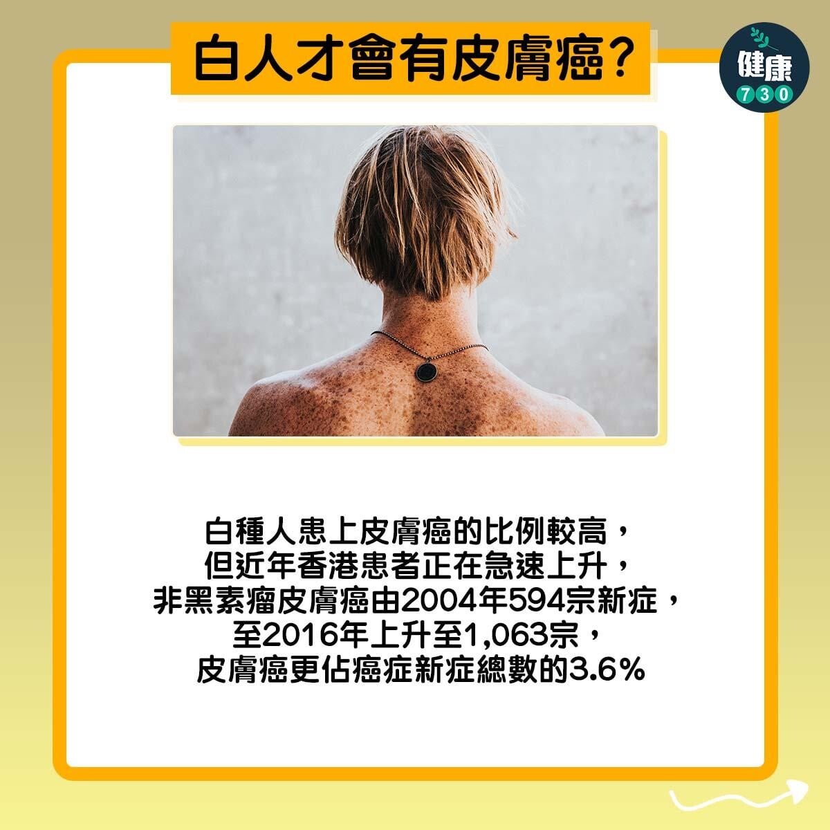 防曬|皮膚癌3大謬誤。(am730製圖)