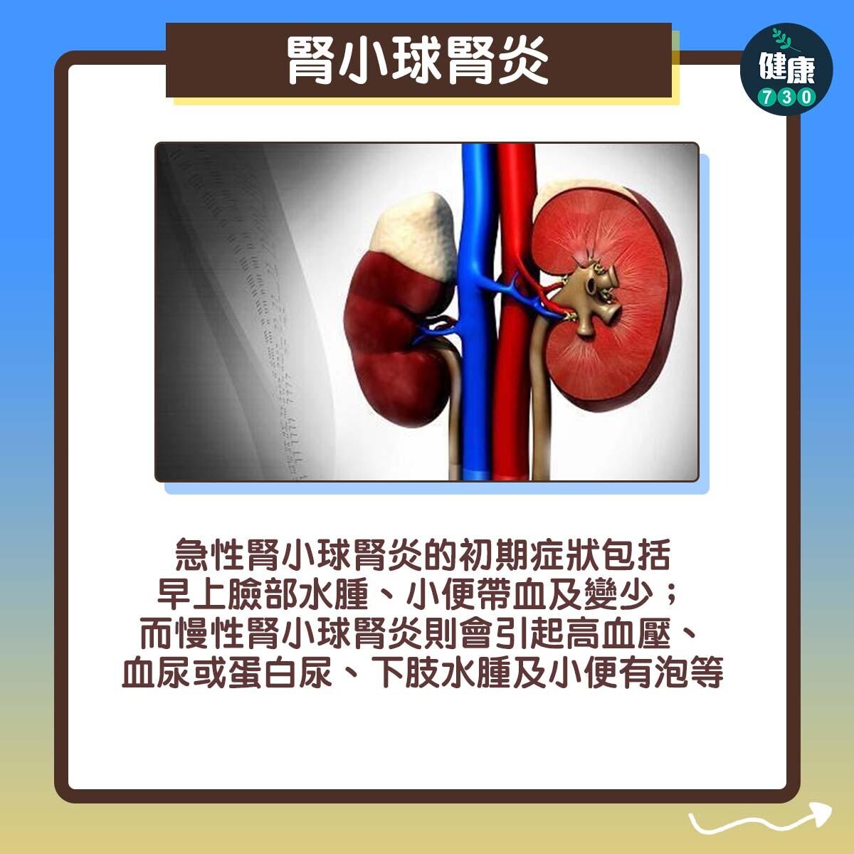 水腫｜自我測試（am730製圖）