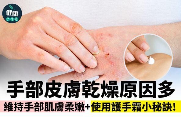 手部皮膚乾燥原因及護手霜用法（am730製圖）