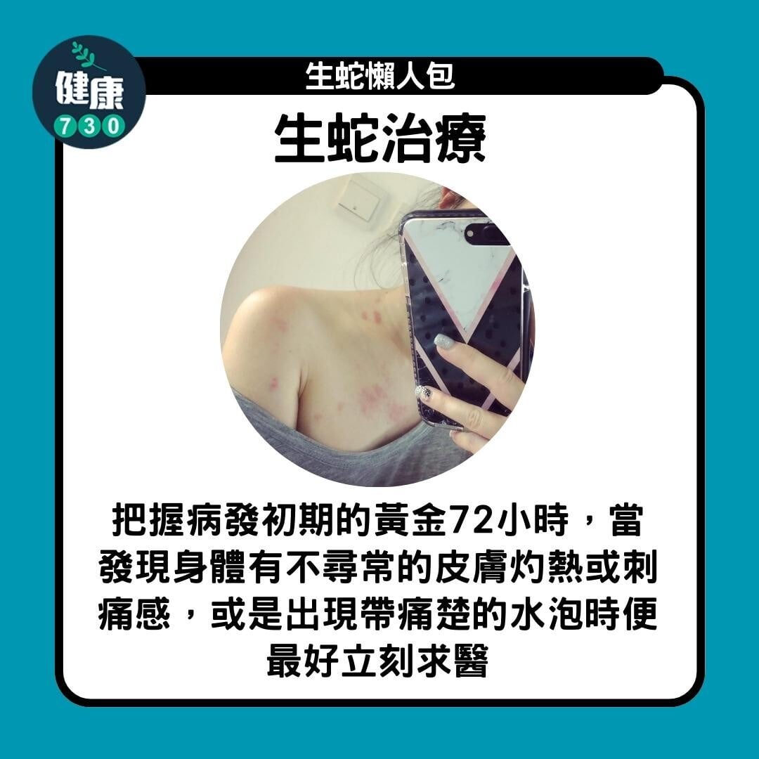 生蛇懶人包,生蛇治療(am730製圖)