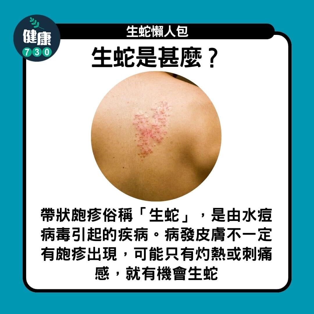 生蛇懶人包,生蛇是甚麼?(am730製圖)
