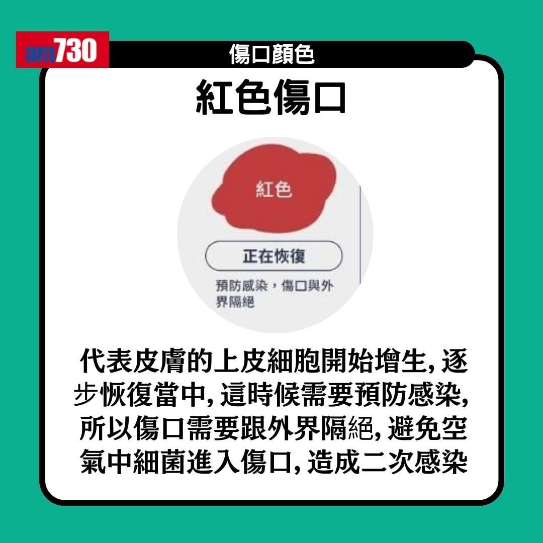 傷口顏色|紅黃綠黑有咩唔同?小心處理加速癒合時間(am730製圖)