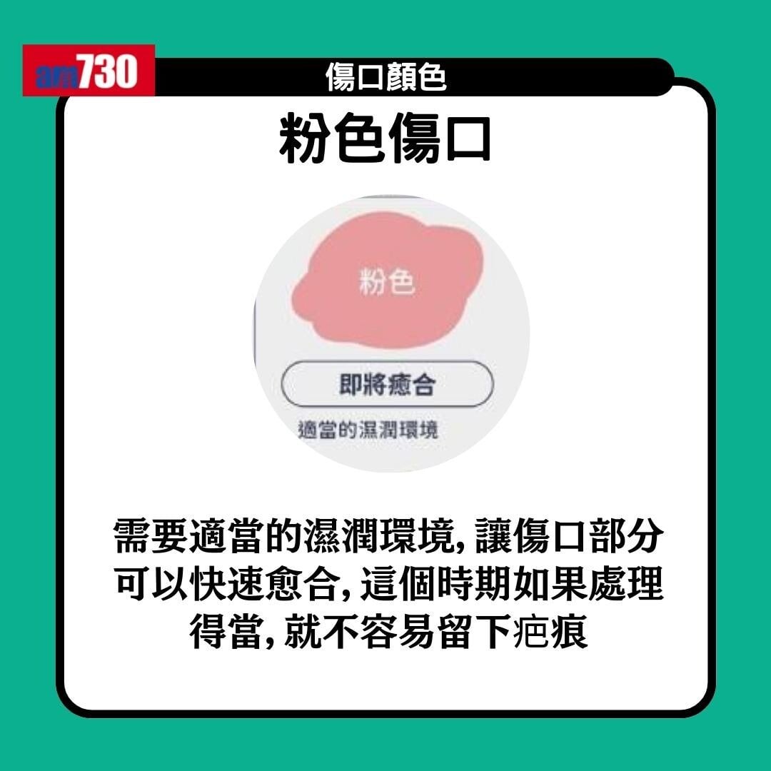 傷口顏色|紅黃綠黑有咩唔同?小心處理加速癒合時間(am730製圖)