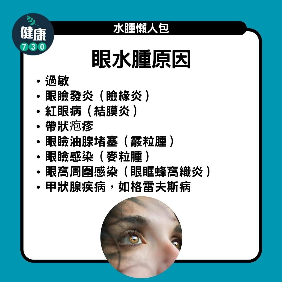 水腫原因及解決方法,眼(am730製圖)