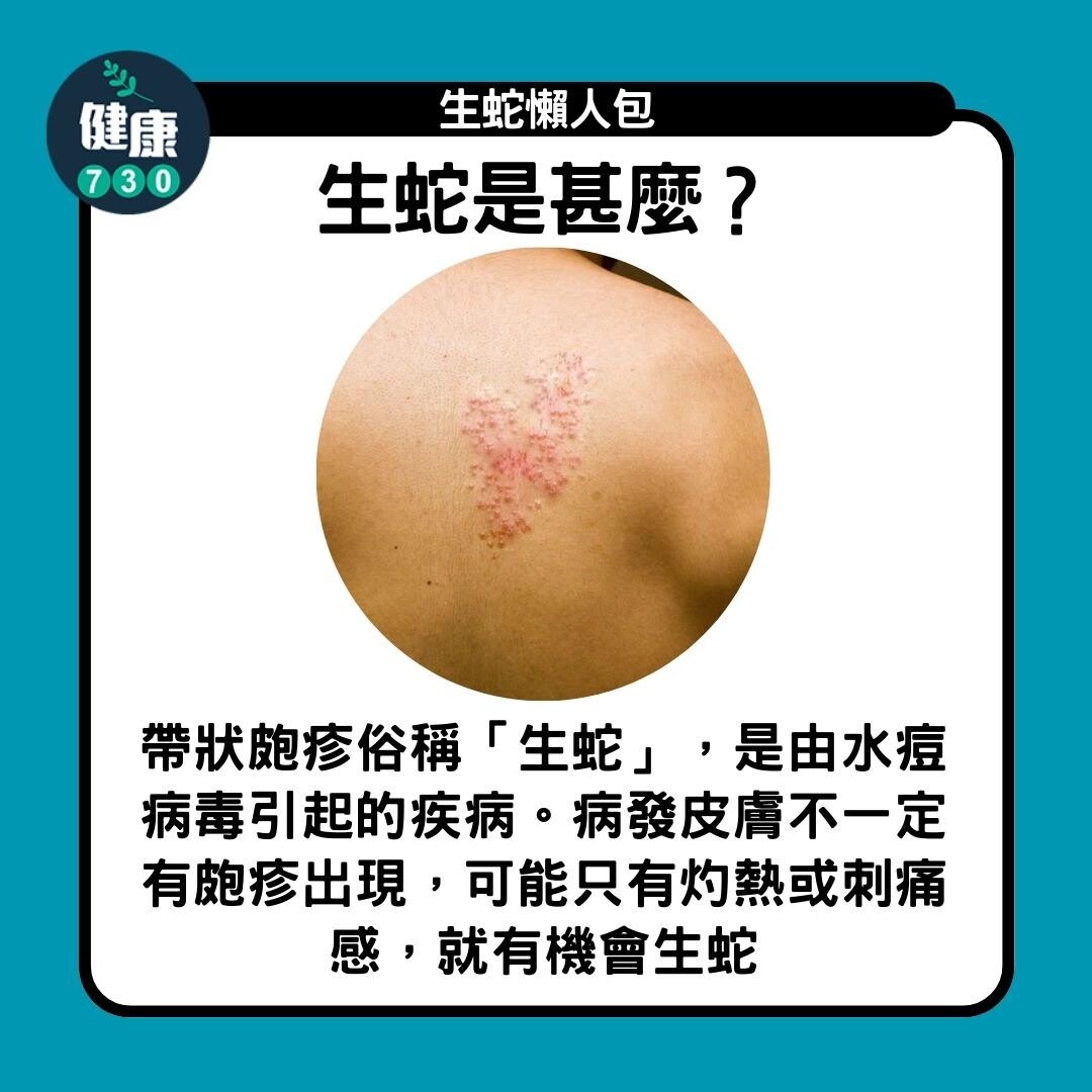 生蛇懶人包,生蛇是甚麼?(am730製圖)