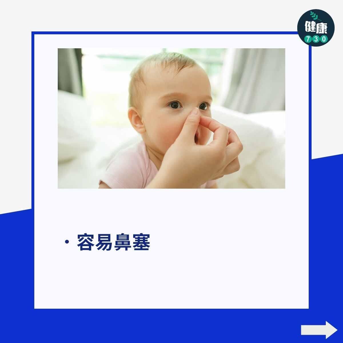 鼻敏感|過敏性鼻炎症狀,容易鼻塞(am730製圖)