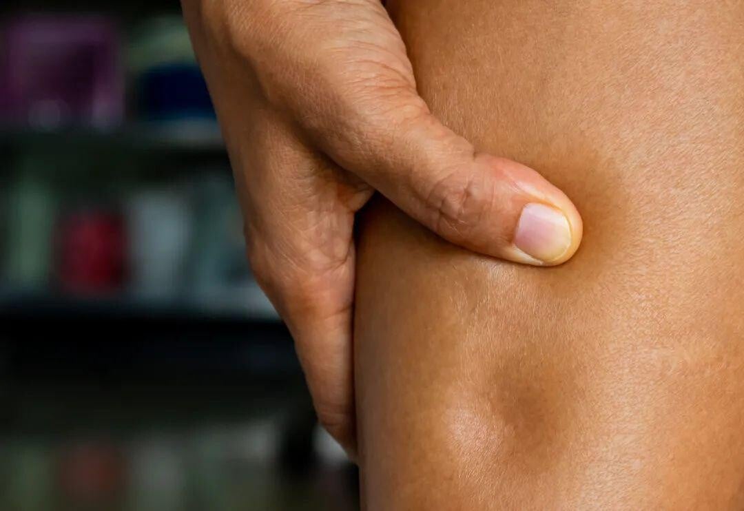 濕氣易水腫 生薑、薏仁、粟米鬚助去濕兼美顏