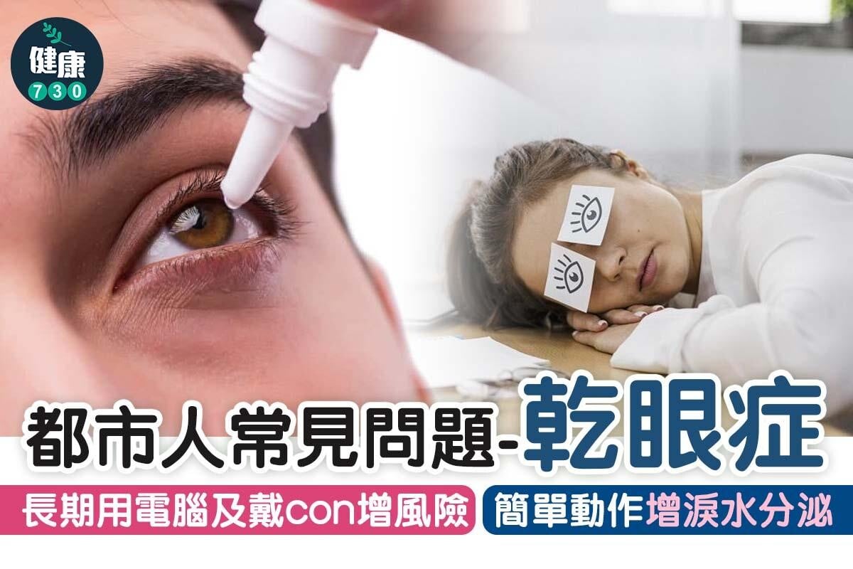 乾眼症原因|長期用電腦及賽con增風險(am730製圖)