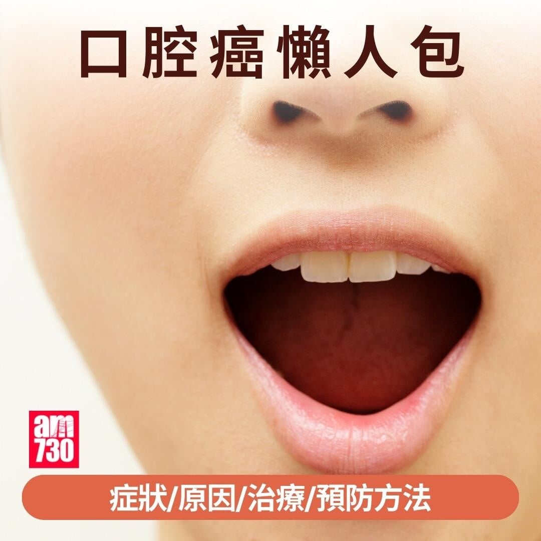 口腔癌原因/症狀/治療/預防方法|(am730製圖)