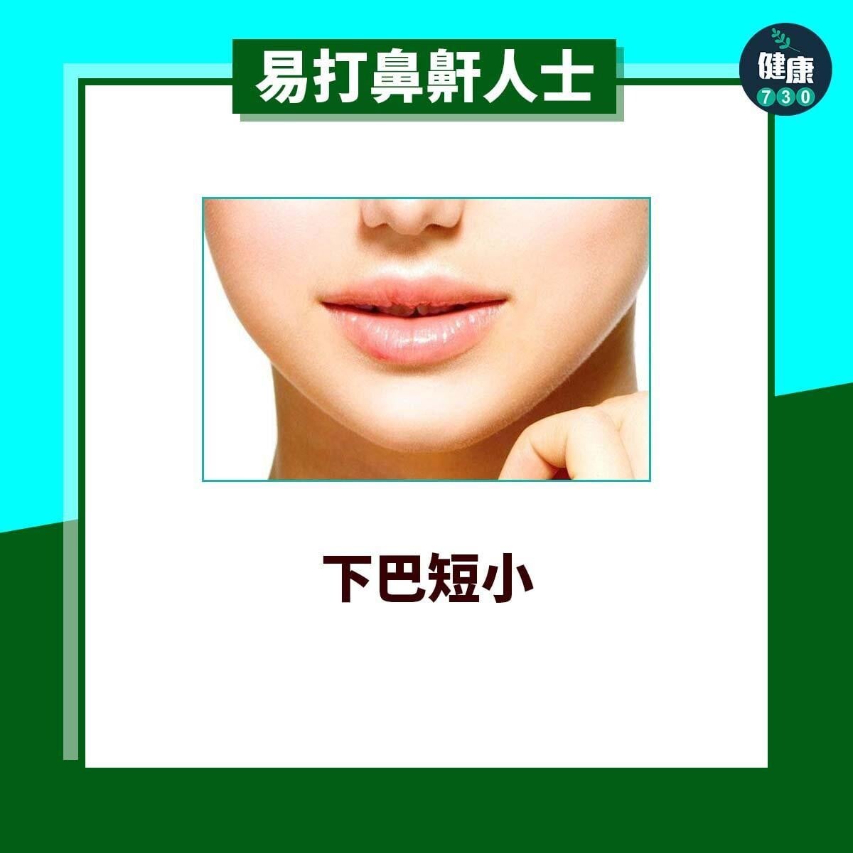 易打鼻鼾人士｜下巴短小（am730製圖）