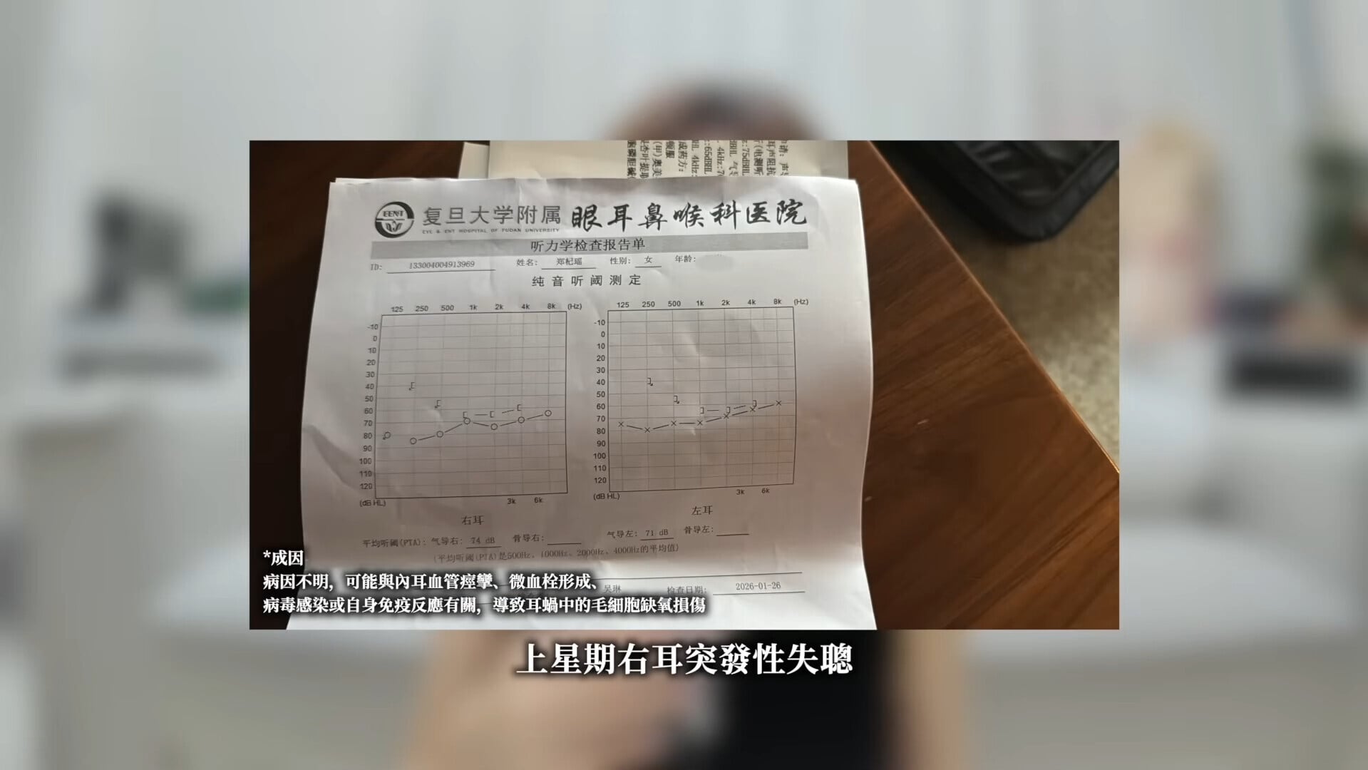 VS YouTube KylieC1 0’18”