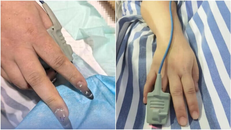 女子因美甲差點延誤急救。（圖／翻攝新浪微博）