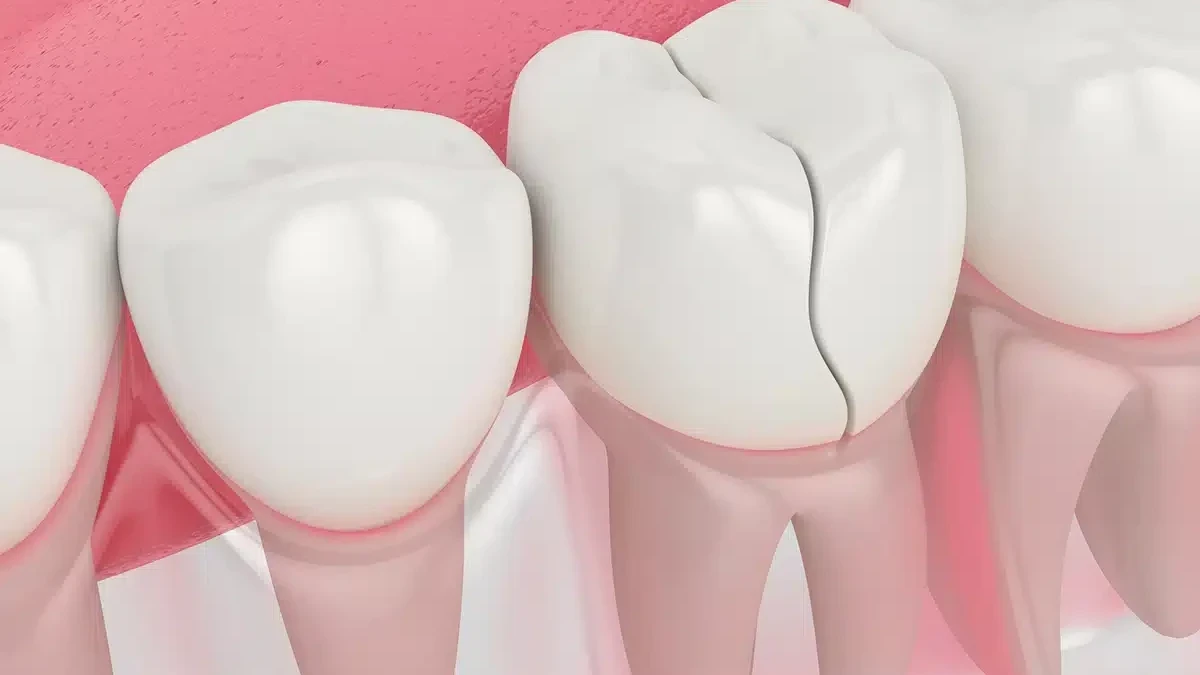 咬合文化學：從港人食魚蛋、飲奶茶、咬骨頭看出甚麼牙齒習慣？