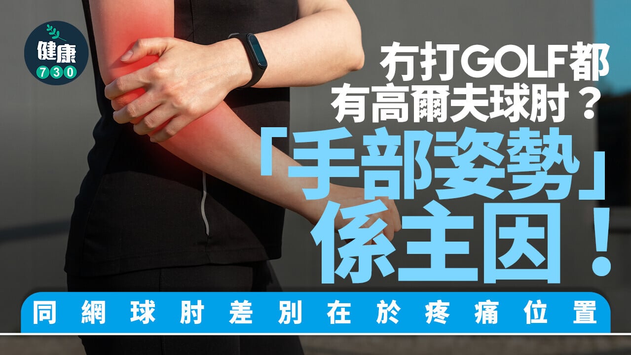 高爾夫球肘的正式名稱為「肱骨內上髁炎」，與常聽到的網球肘同屬常見手肘疼痛問題，但位置不同。