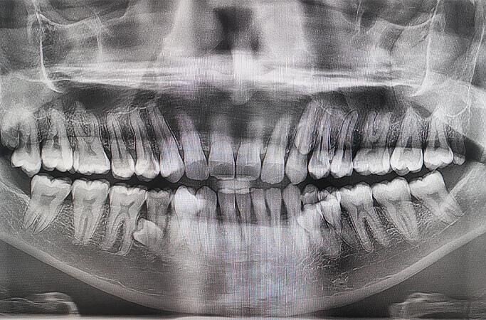 Cut 1773457686 qSZH2iF
