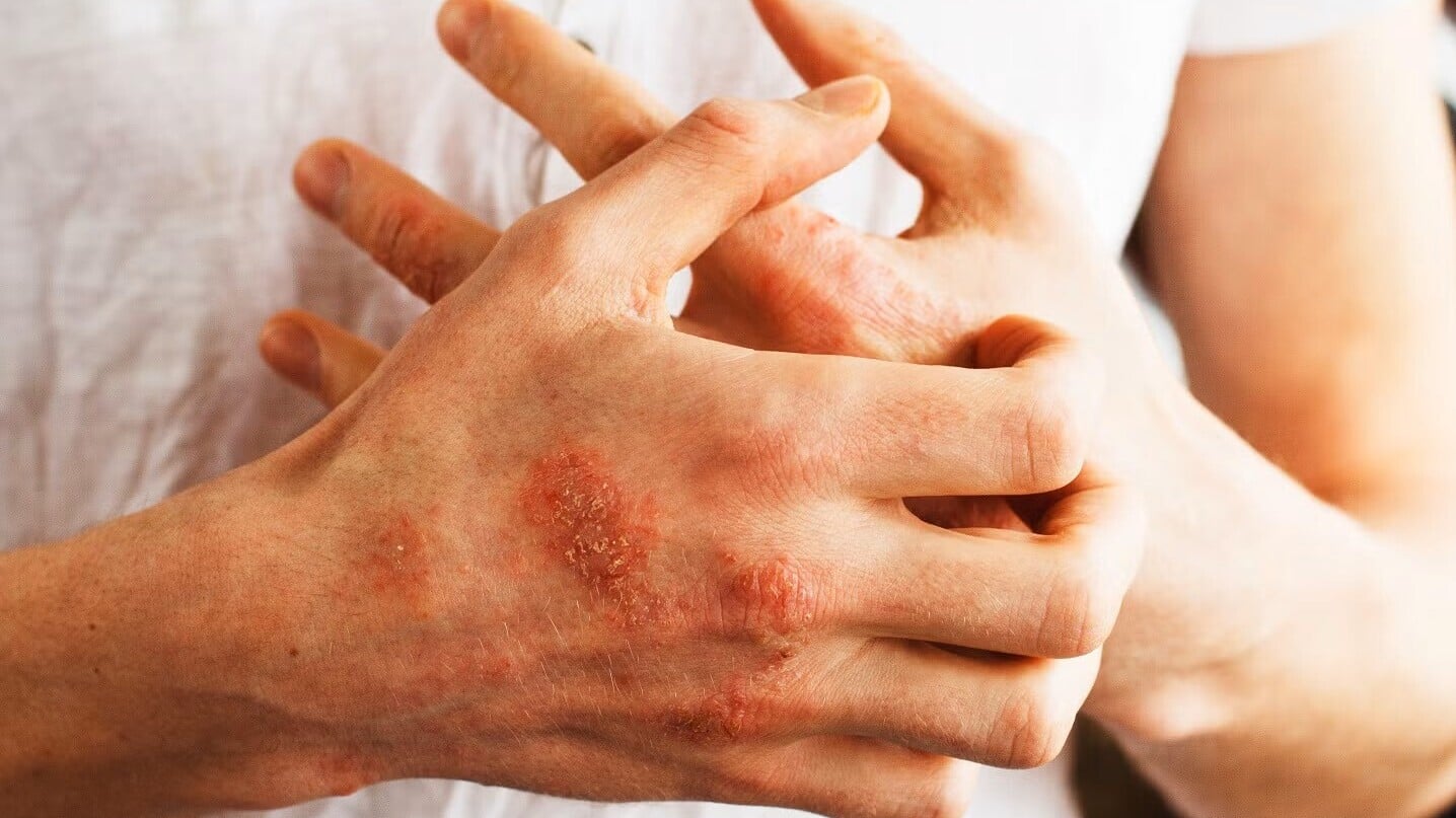 Bio Thera