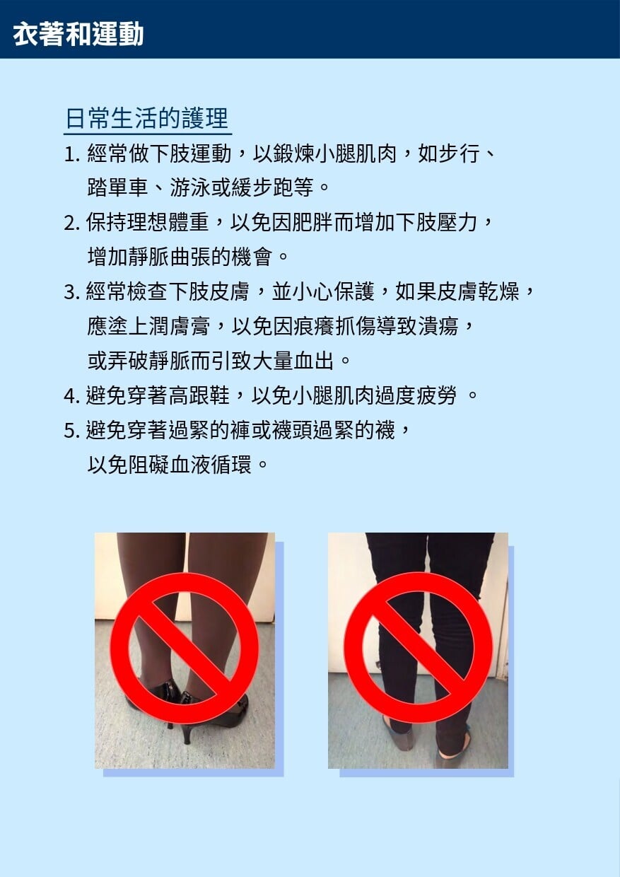 靜脈曲張護理及保健運動,衣著和運動(衛生署)