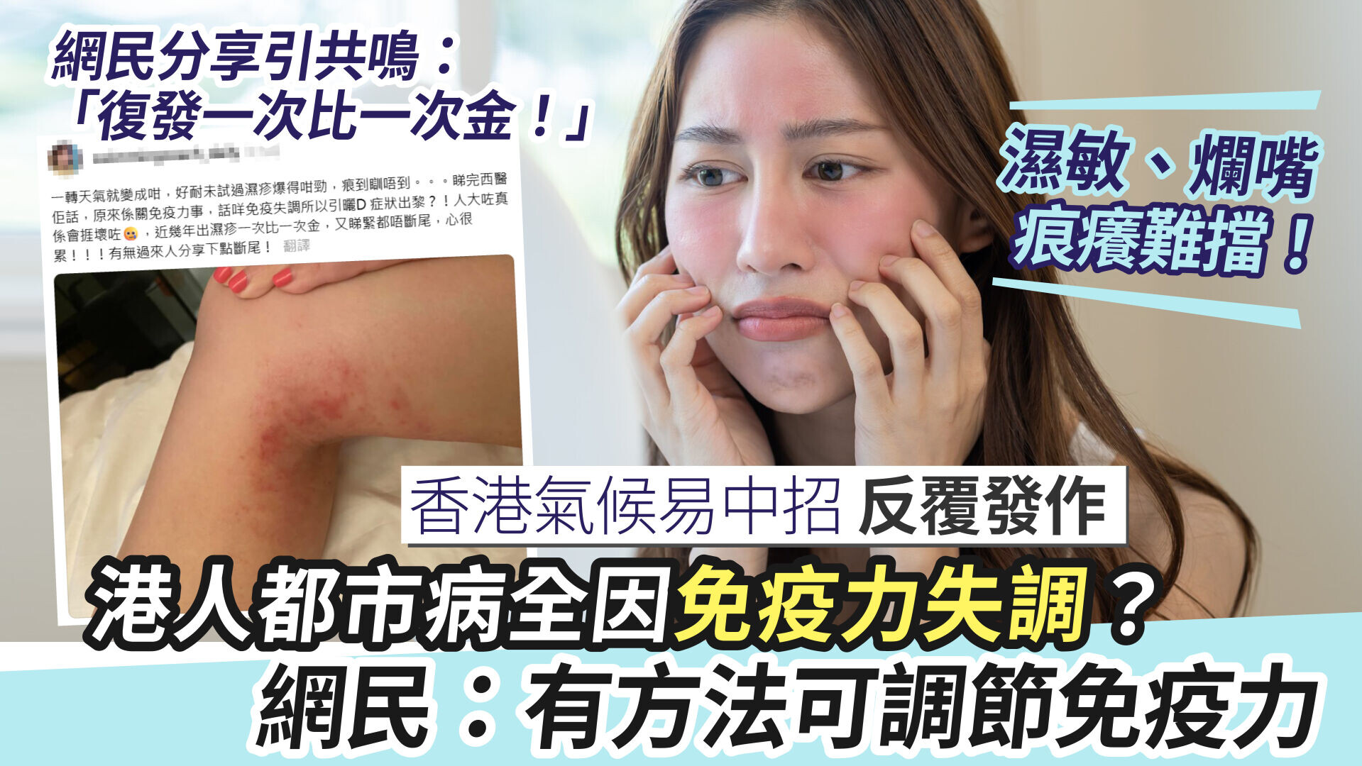 濕敏、爛嘴是身體免疫力響警號