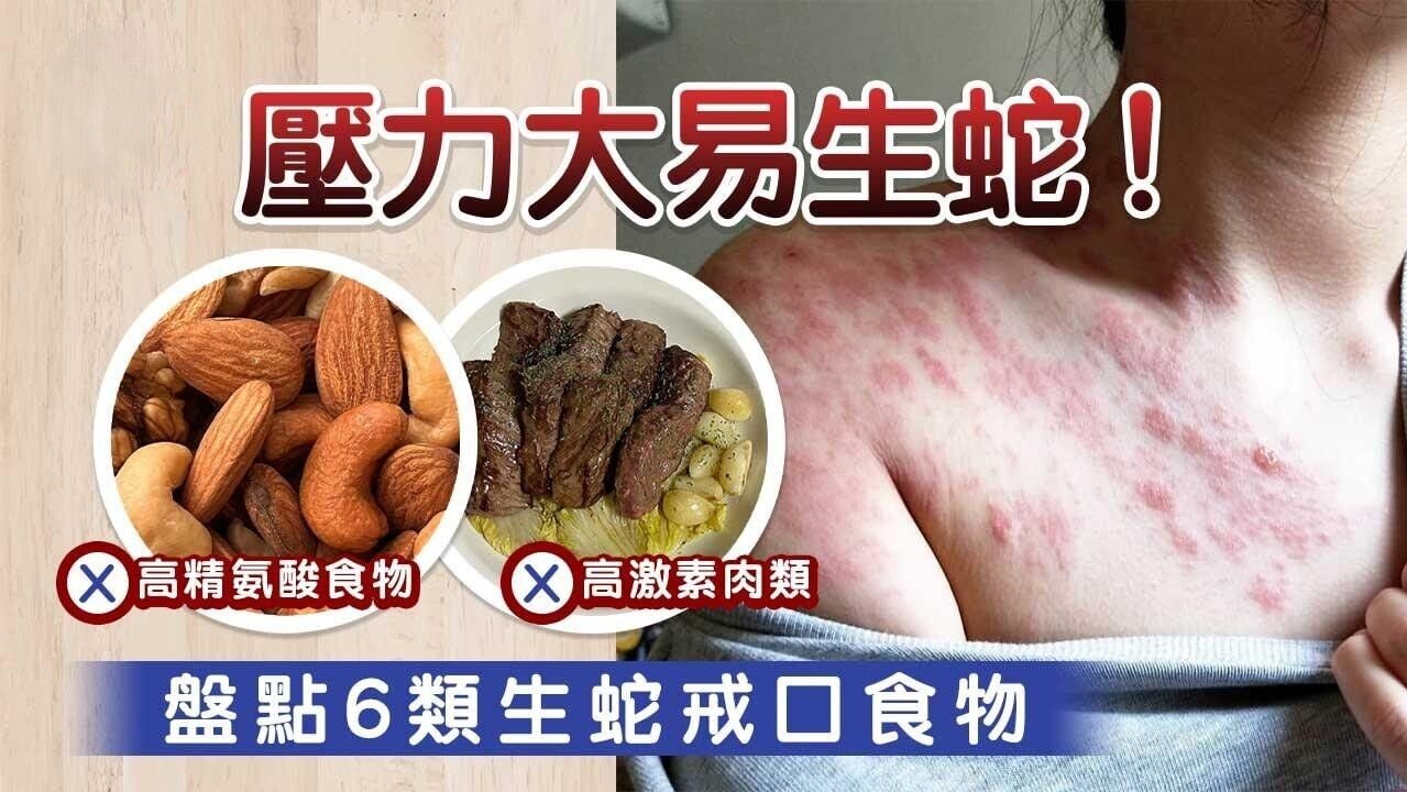 生蛇原因源自壓力大！戒口6類食物 雞肉、牛肉唔食得！