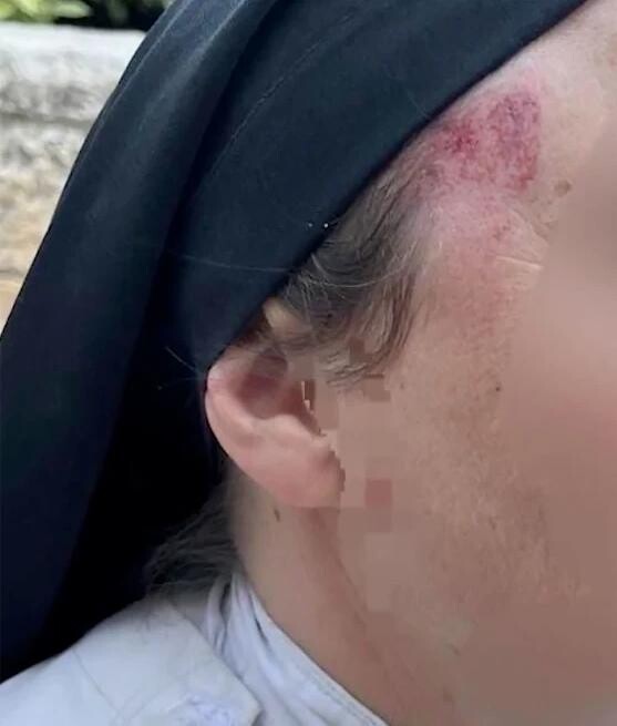 一名修女在耶路撒冷遭人襲擊。（圖／翻攝自X@israelpolice）