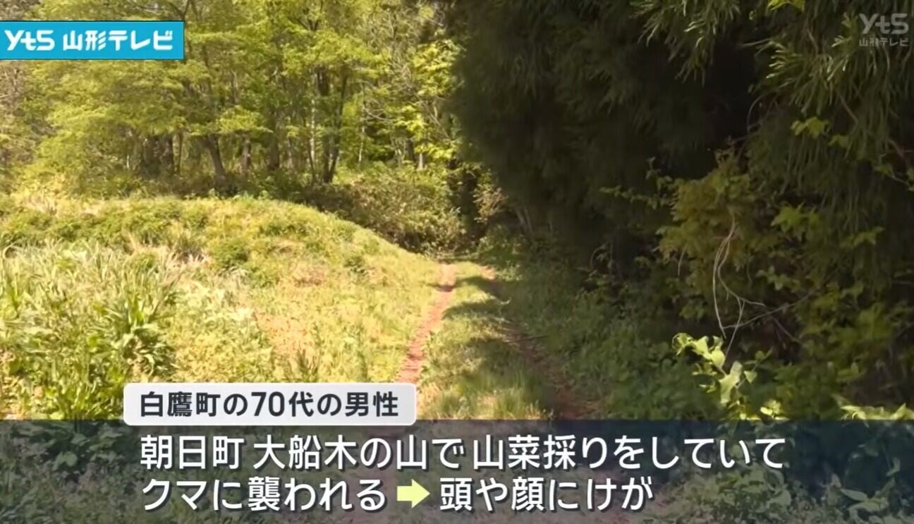 日本熊患