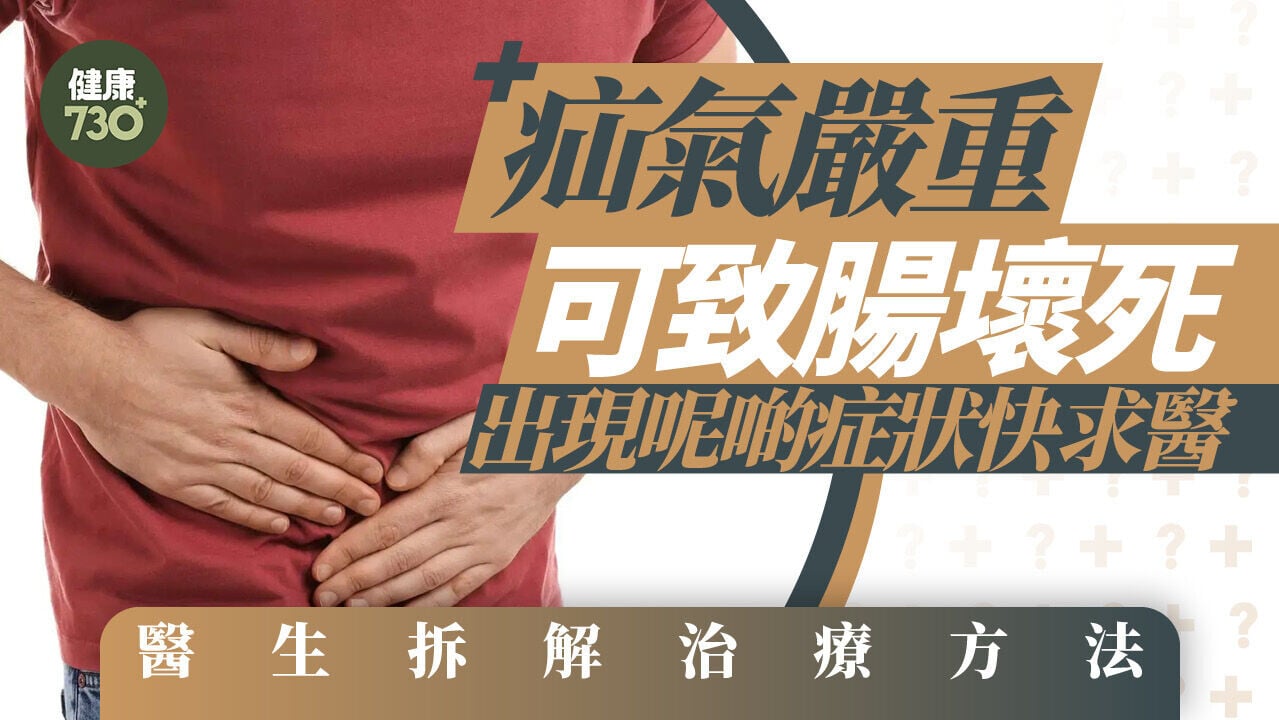 疝氣嚴重可致腸壞死！出現呢啲症狀快求醫 醫生拆解治療方法