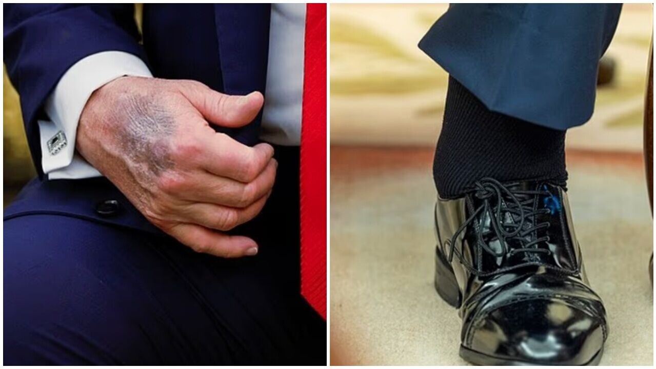 特朗普下月滿80歲,身體狀況惹揣測。(X)