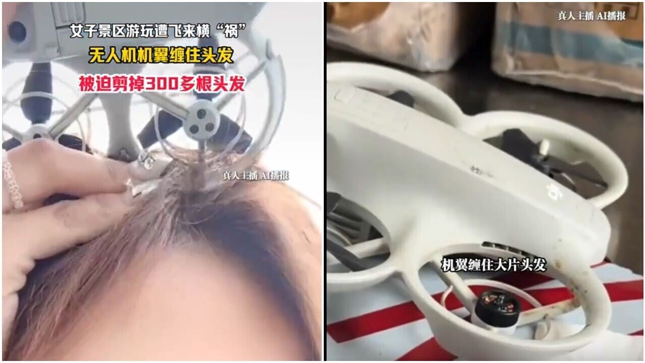 無人機的螺旋槳緊緊纏繞女事主頭髮。(中安在綫)