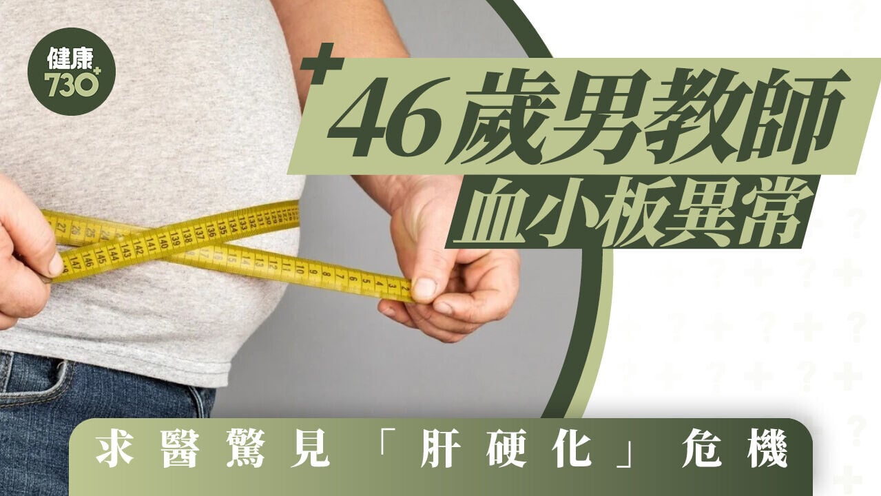 46歲男教師血小板異常 求醫驚見「肝硬化」危機