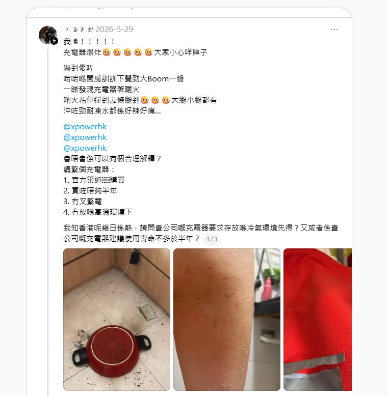 另一位事主慘遭燒傷。(相片來源:Threads)