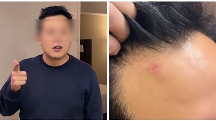 內媒指遭遇搶劫的是球迷李先生和王先生。他們描述在抵達墨西哥僅半個小時後，便在機場附近路段遭遇當地的「飛車黨」，一人接應一人搶劫。