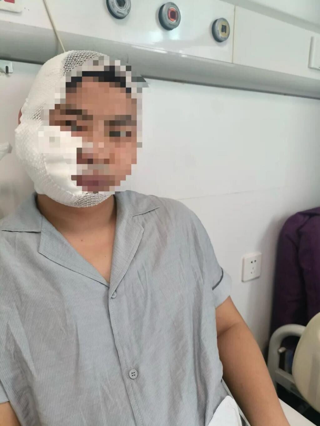 包男右側顳頂部頭皮撕脫傷、右側臉部皮膚挫裂傷,臉部嚴重毀容