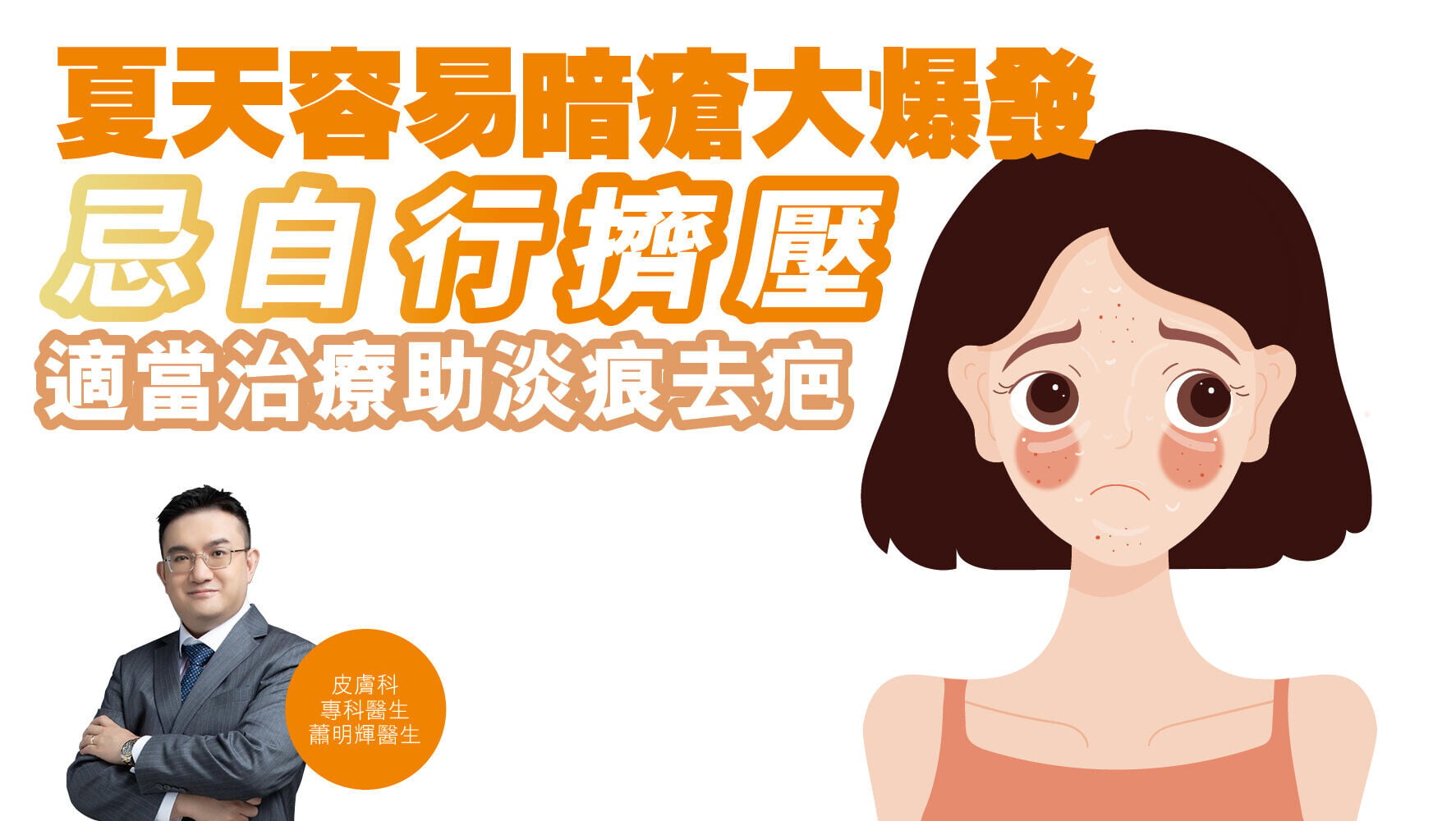 健康解碼｜夏天容易暗瘡大爆發 忌自行擠壓 適當治療助淡痕去疤