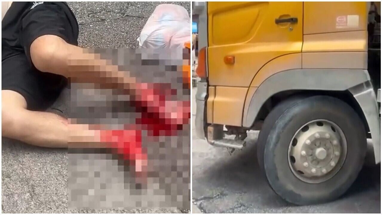土瓜灣男途人捱貨車撞，腳掌被輾骨折嚴重受傷。(網上截圖)