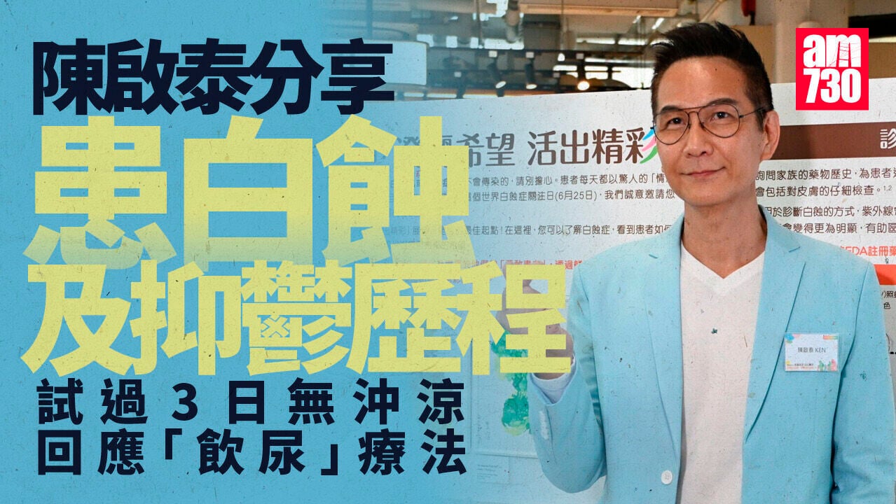 陳啟泰受白蝕與抑鬱困擾 自困家中3日沒沖涼 開腔回應特別排毒療法
