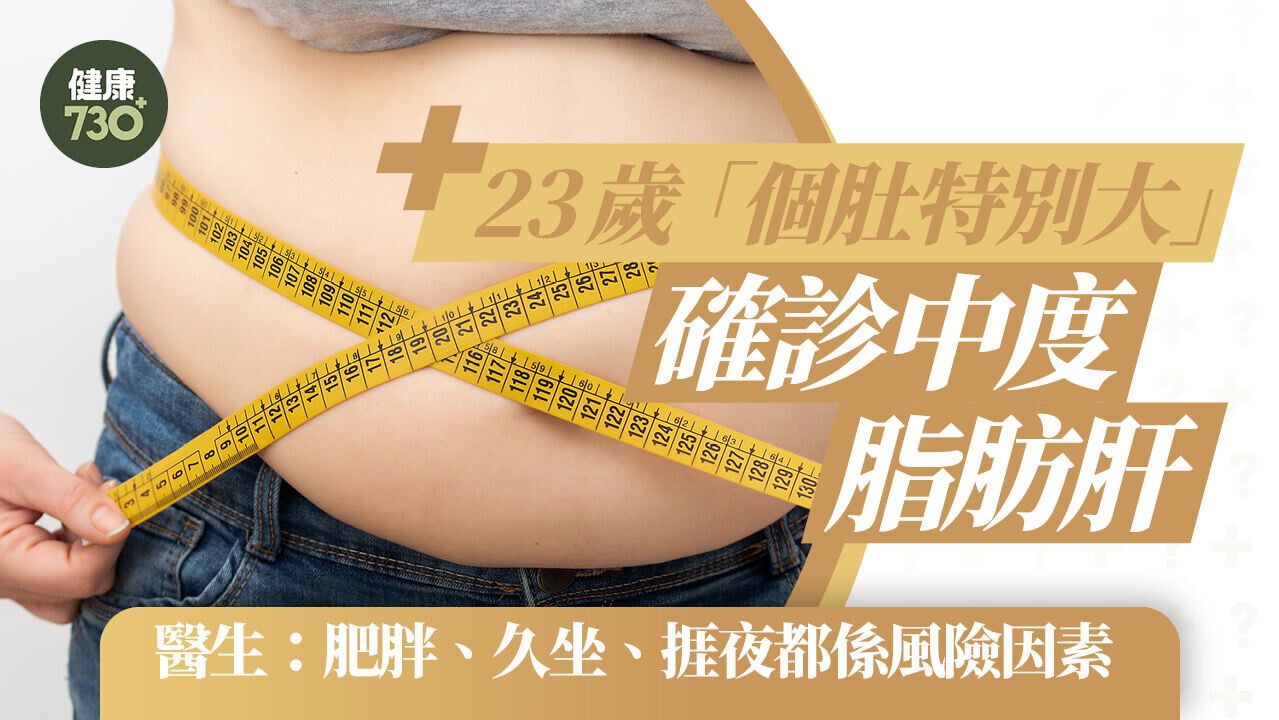 23歲「個肚特別大」確診中度脂肪肝 醫生：肥胖、久坐、捱夜都係風險因素