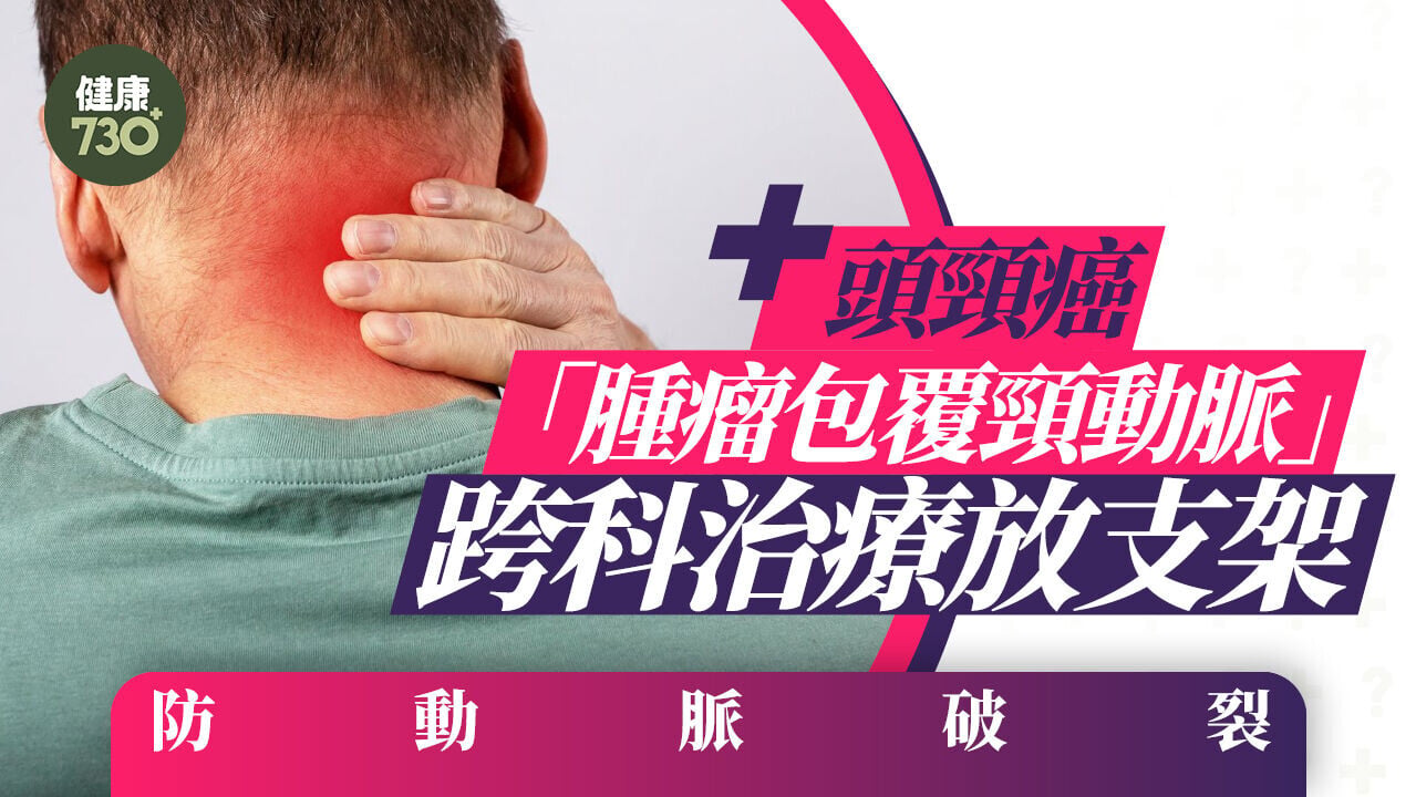頭頸癌「腫瘤包覆頸動脈」跨科治療放支架防動脈破裂
