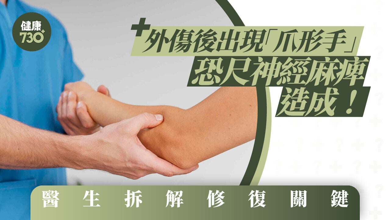 外傷後出現「爪形手」恐尺神經麻痺造成！醫生拆解修復關鍵