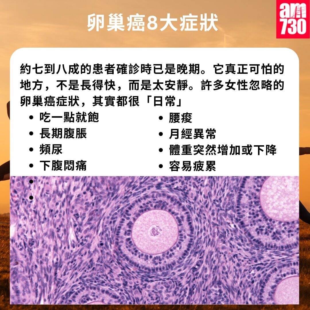 卵巢癌8大症狀（am730製圖）