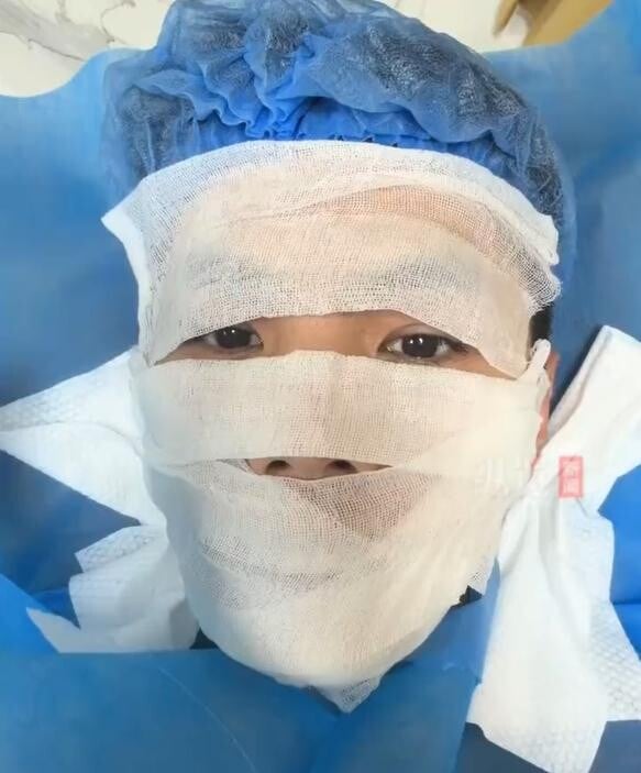 馮姓男子分享健身後臉部真菌感染經驗。 （圖／翻攝縱覽新聞）