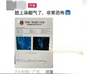 馮姓男子近日接受媒體採訪表示,自己平時健身時沒有戴手套