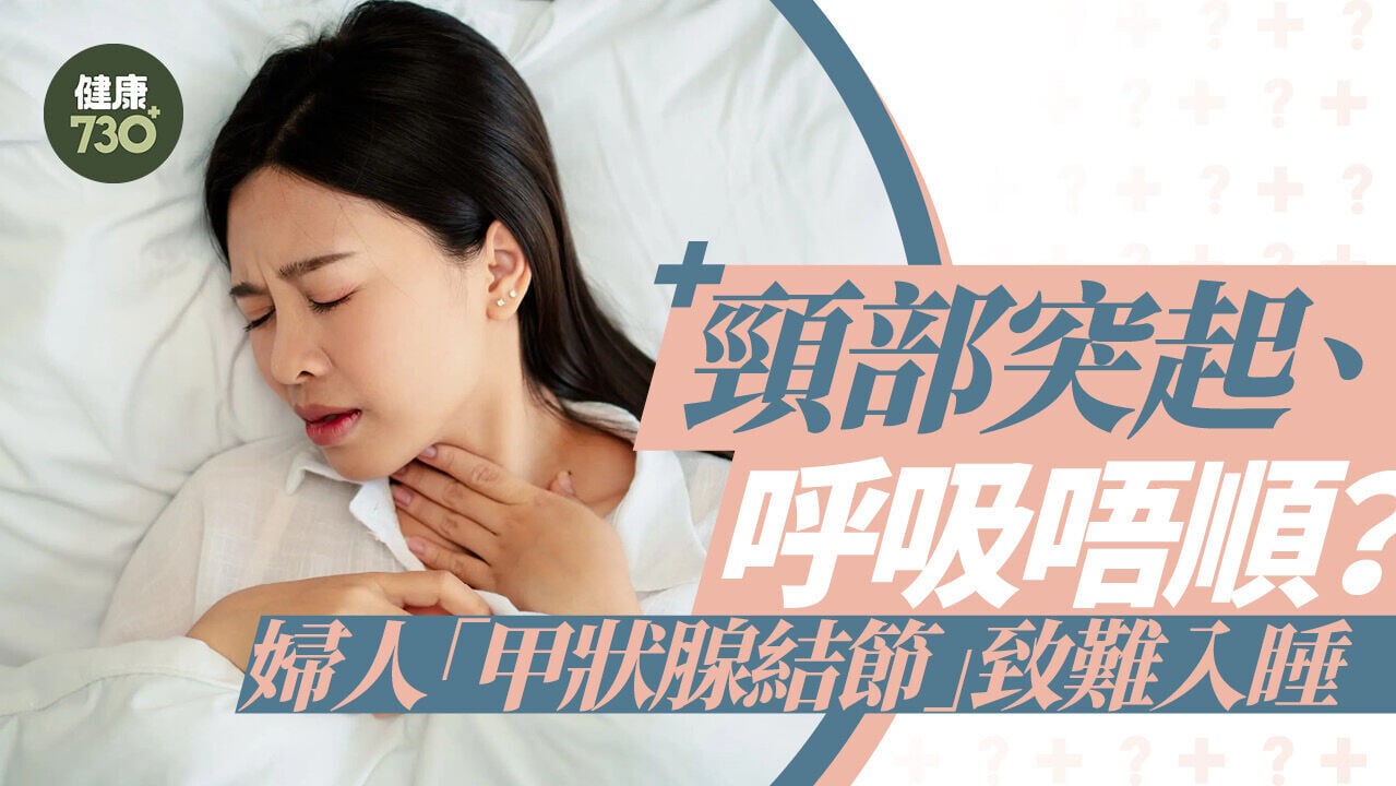 頸部突起、呼吸唔順？婦人「甲狀腺結節」致難入睡