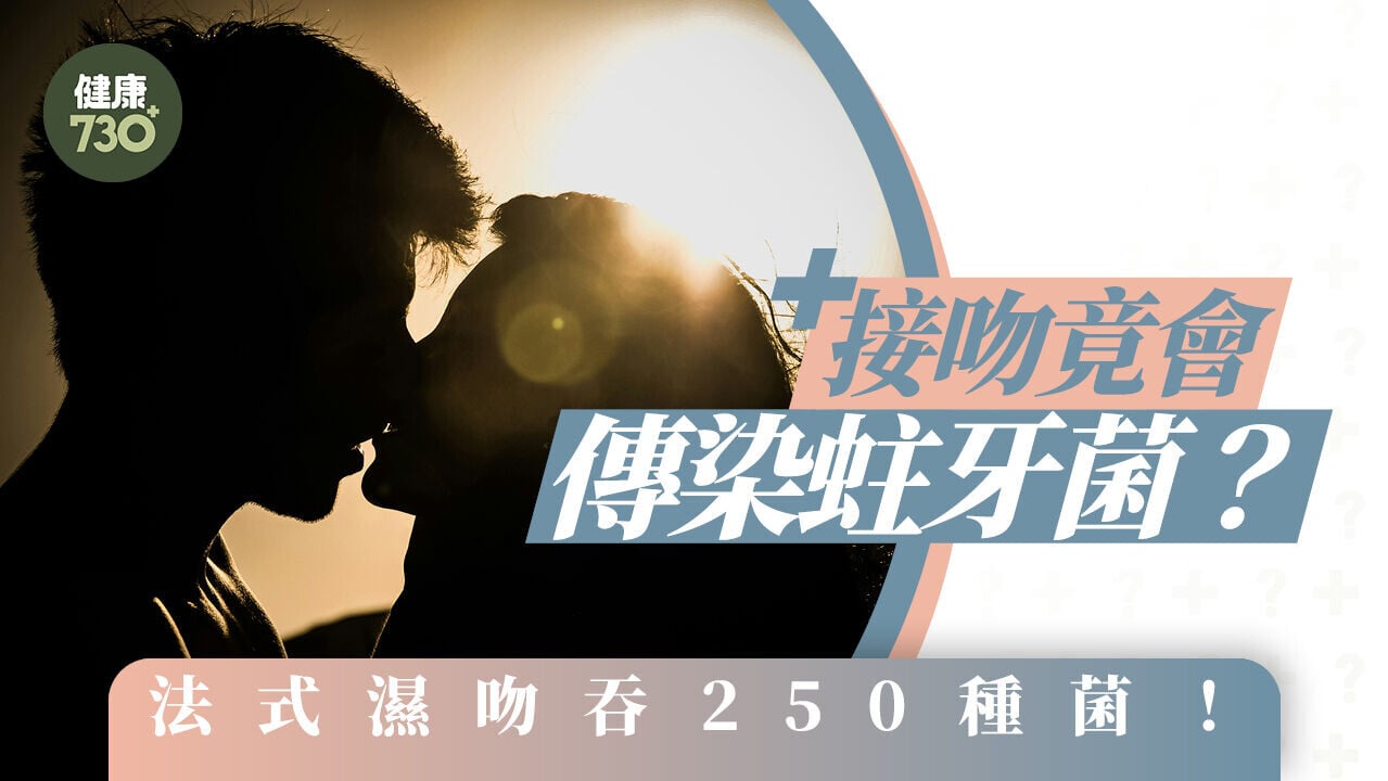 牙醫警告｜接吻竟會傳染蛀牙菌？法式濕吻吞250種菌！