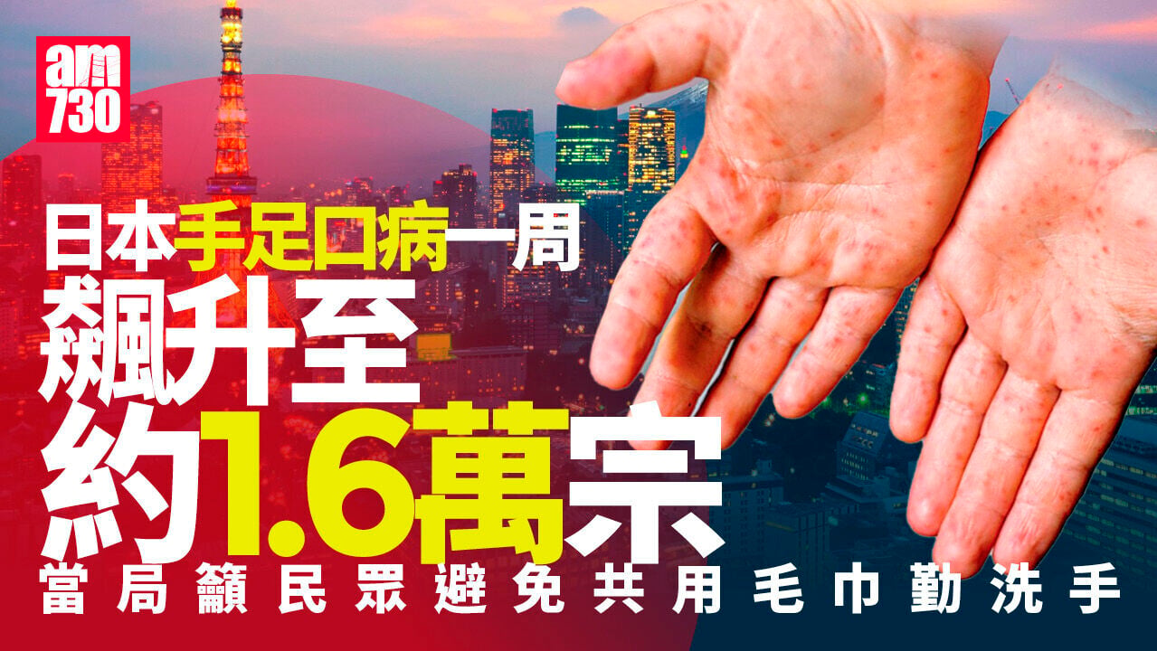 日本手足口病一周飆52% 27都府縣達流行警報水平 東京都平均第3多