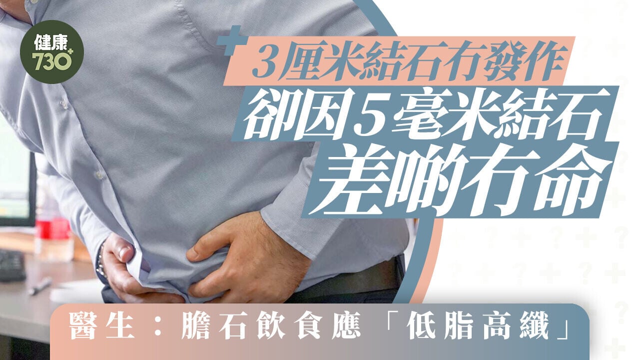 3厘米結石冇發作卻因5毫米結石差啲冇命 醫生：膽石飲食應「低脂高纖」